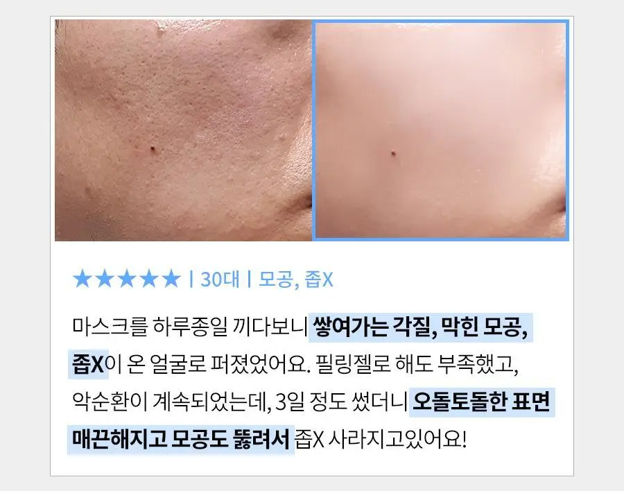 [피지제거/필링] 페이스팩토리 제트 필링기 상세페이지 15